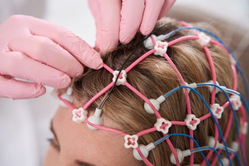 “Here’s How I Knew I Had Narcolepsy”: A Patient’s Story After Extreme Fatigue