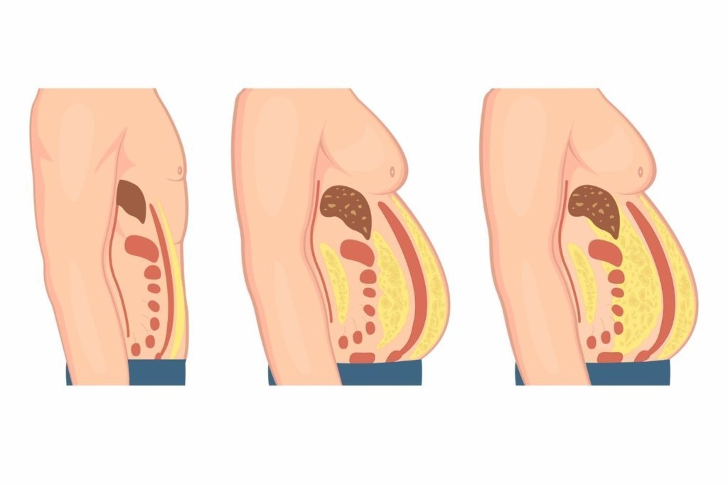 Break Free From Hidden Belly Fat Traps: 10 Habits Destroying Your Waistline