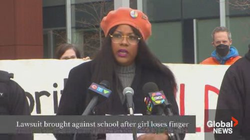 Family launches lawsuit against Hamilton school after girl looses part of her finger