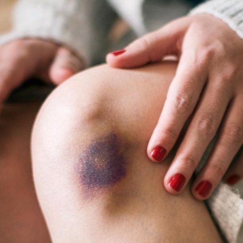 Secret Ways Menopause Affects Your Skin—and How to Fix It