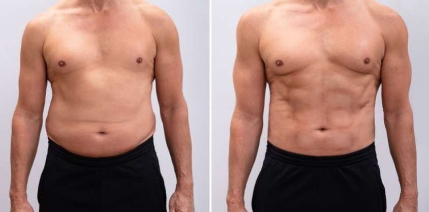 How to Lose Belly Fat Fast for Men, According to Science