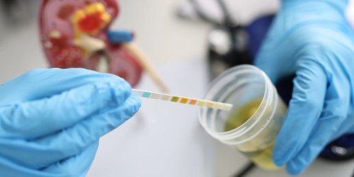 10 Reasons You Might Have Blood in Your Urine