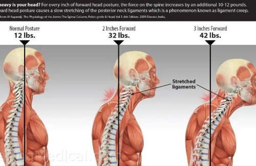How to Correct Your Text Neck Posture to Release Upper Back And Neck Pain