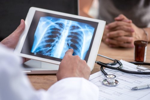 Why Non-Smokers Still Need Lung Cancer Screenings