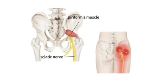 This Piriformis Muscle Stretch Helps Ease the Nerve Tension in Your  Lower Back