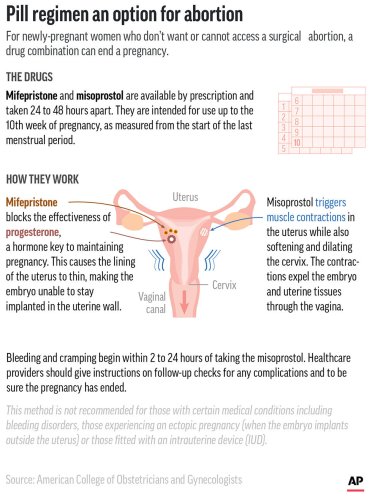Medication abortion is common; here's how it works