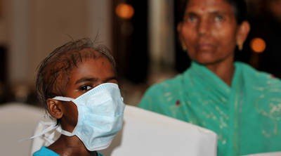 In India, resource scarcity drives healthcare innovation