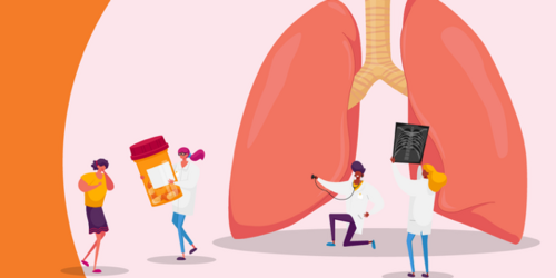 Myths vs. Facts: COPD