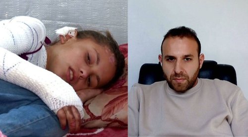 97% of Burn victims died in Gaza as hospitals collapsed under siege, doctor reveals