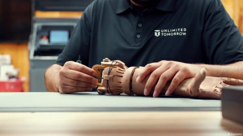 Inventor revolutionizes prosthesis production | Flipboard