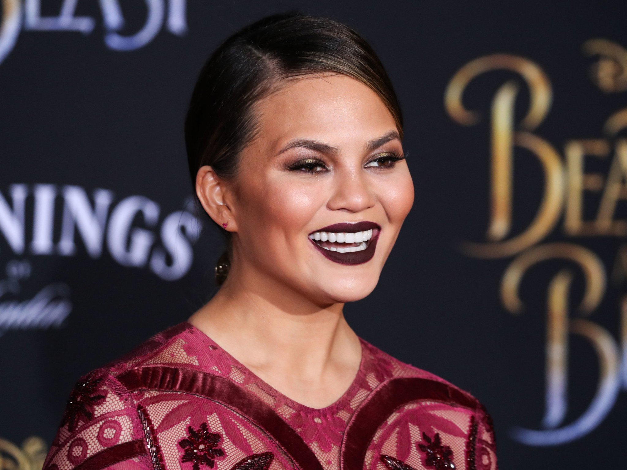 Chrissy Teigen's latest plastic surgery reveal has people riled up