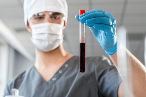 What’s in Your Blood? A Biomarker That Sees Alzheimer’s Coming