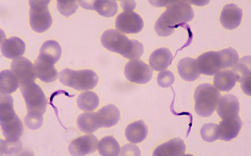 If You Notice This Symptom, It Could Be the Viral Intestinal Parasite