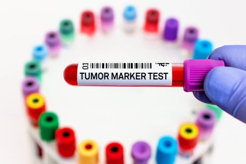 Biomarkers 101