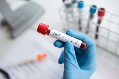 Signs You May Have HIV — Plus More On This Virus