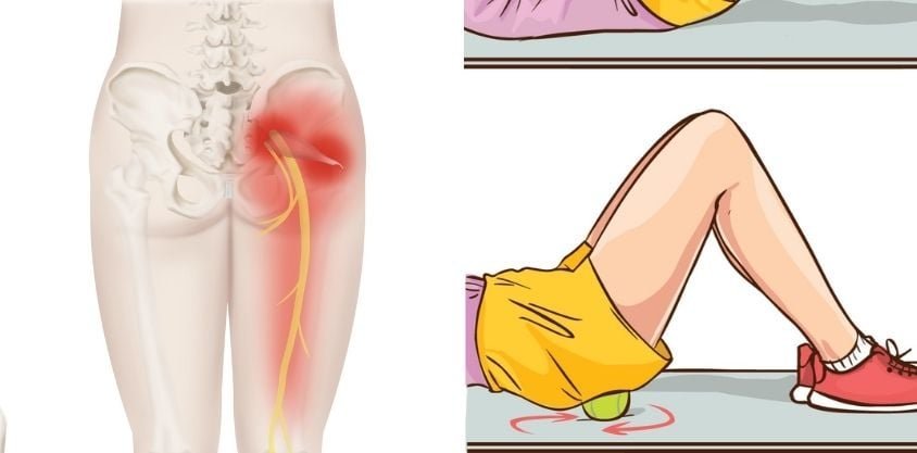 3 Easy Sciatica Exercises To Soothe The Nerve Pain in Your Back, Butt, and Leg