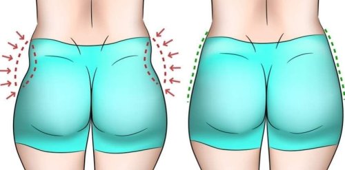 How To Get Rid of Hip Dips: 8 Exercises That Really Work