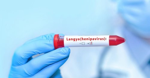 What Is This new Langya Virus? Do We Need to be Worried?