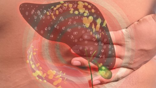What Really Happens To Your Body When You Have Fatty Liver Disease