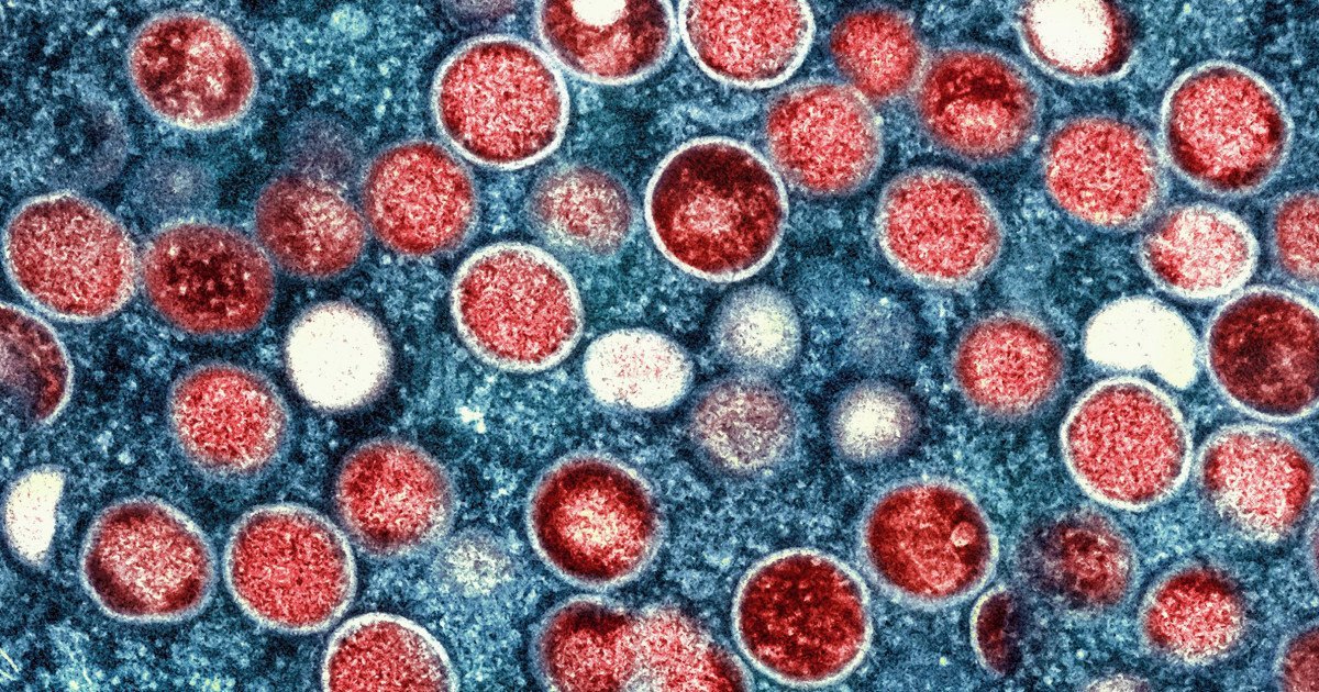 U.S. officials declare monkeypox a public health emergency