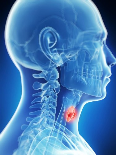Signs You May Have a Thyroid Problem