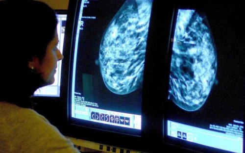Breast cancer drug that costs just 4p could save lives of women at high risk of the disease