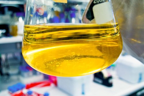 Particles in Urine: 10 Potential Causes