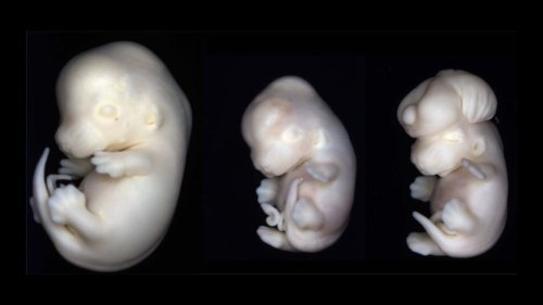 Weirdest Medical Anomalies in the Delivery Room