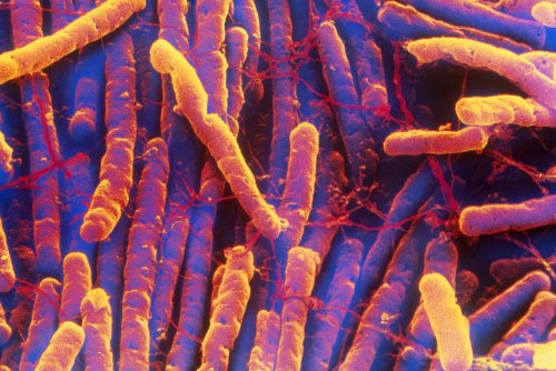 C. Diff Infections Are Falling, Thanks To Better Cleaning And Fewer Antibiotics