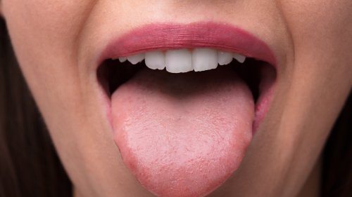 What Does It Mean If Your Tongue Is Pale?
