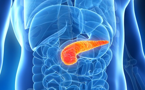 What is Pancreatitis?