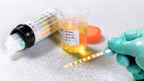 Can I Pass a Drug Test With Someone Else's Urine? — Plus More on Drugs & Alcohol