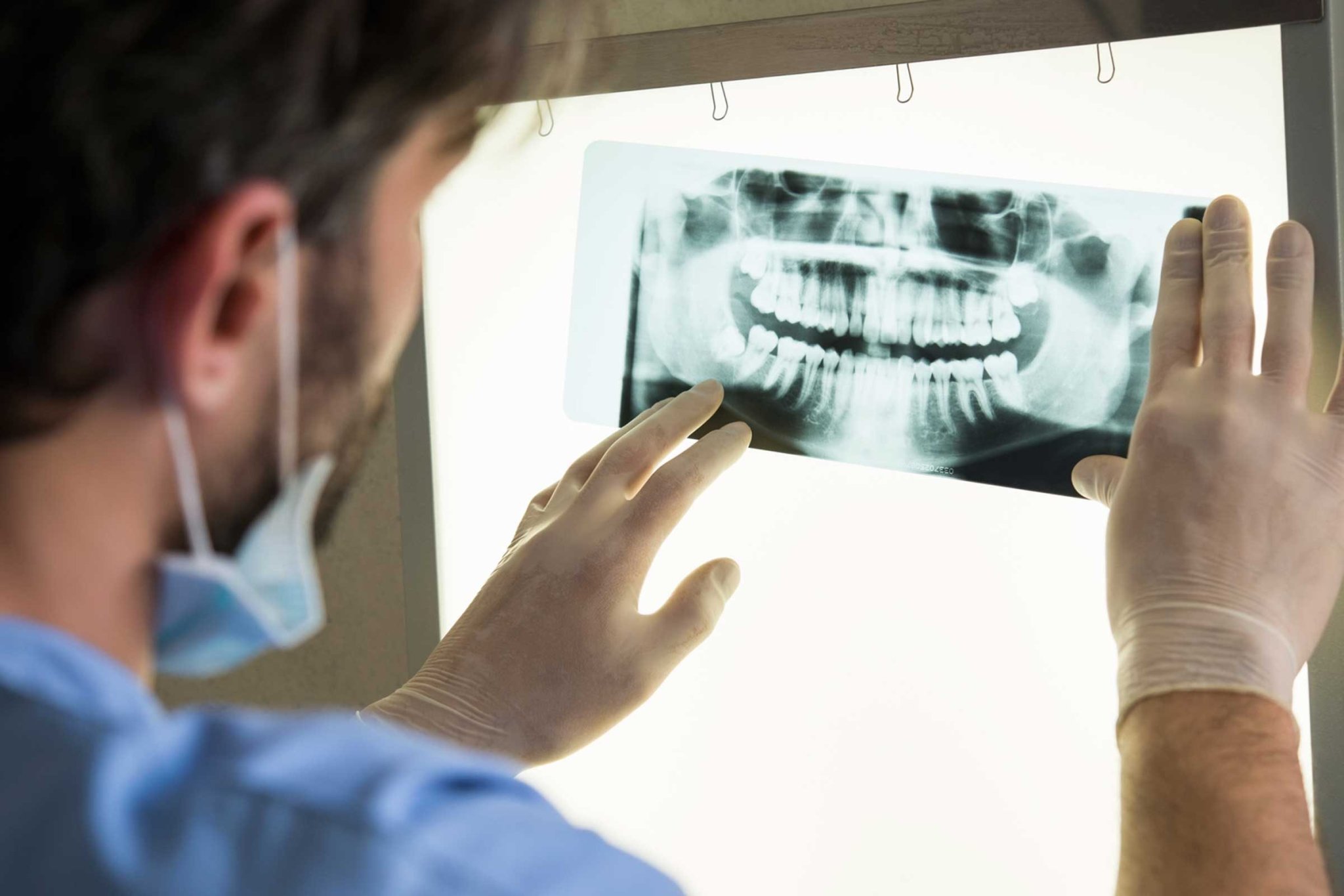 Tooth Infections Can Be Fatal, and Other Weird Dental Wisdom