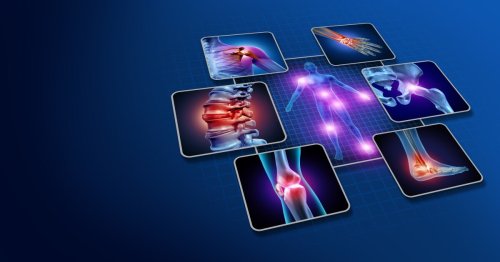 How tiny electrical implants could treat rheumatoid arthritis