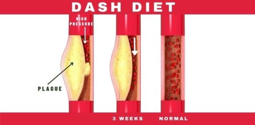Experts Trust This Diet to Clean Your Arteries And Protect You From Hypertension