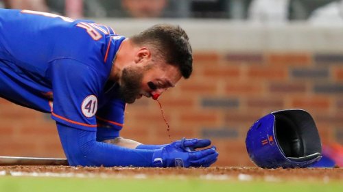 Mets’ Kevin Pillar drilled in face by pitch, has multiple nasal fractures