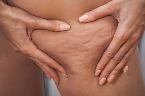 Foods + Tricks to Fight Cellulite