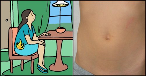 7 Kinds Of Farts You Need To Tell Your Doctor About Right Away