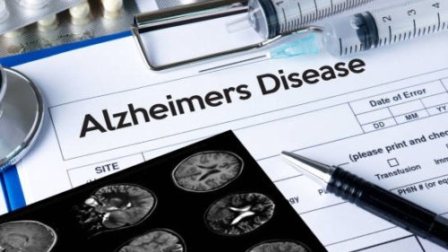 Small Lab-Made Proteins May Help Treat Alzheimer’s
