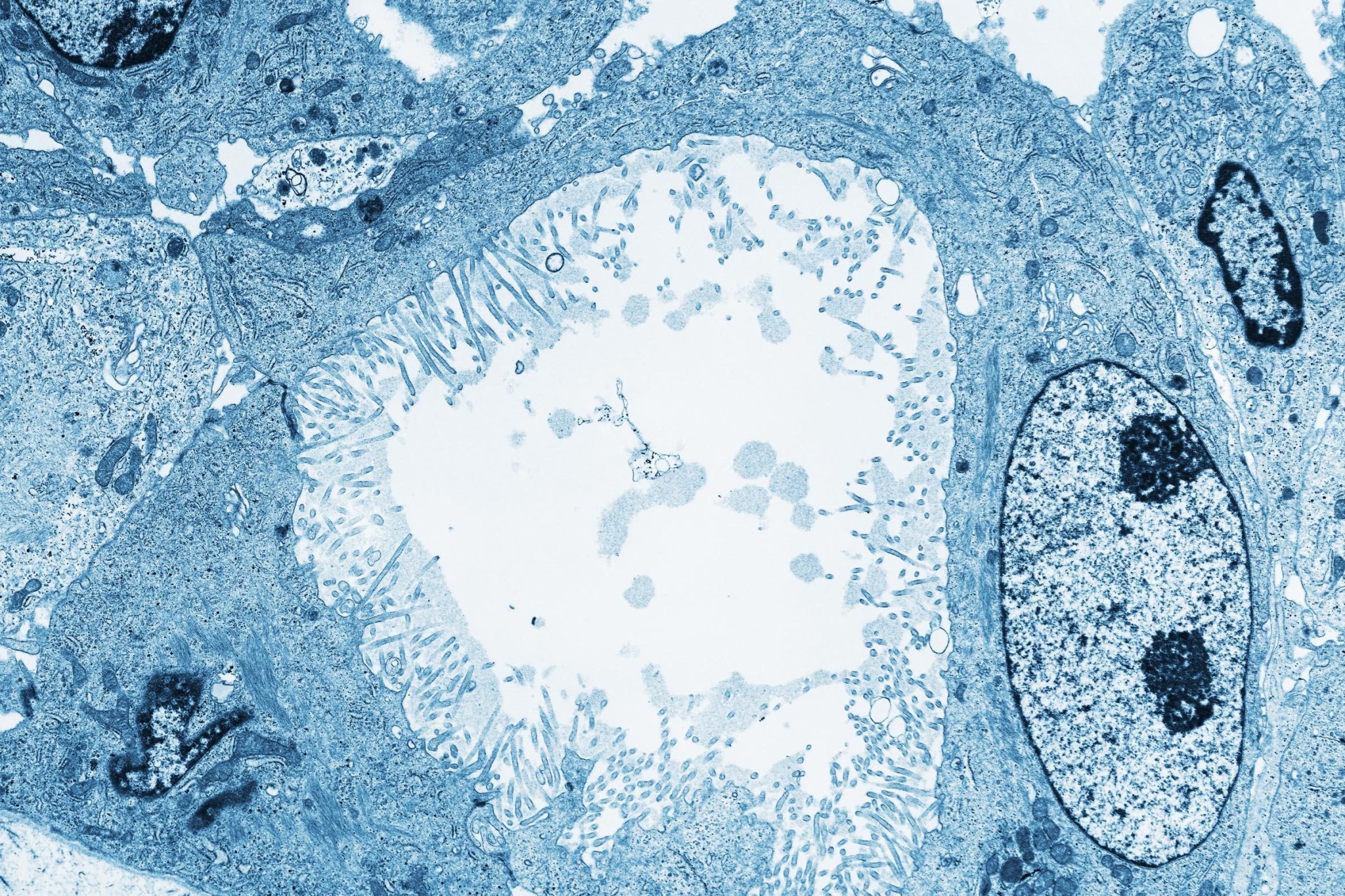 “Here’s How I Knew I Had Stomach Cancer”