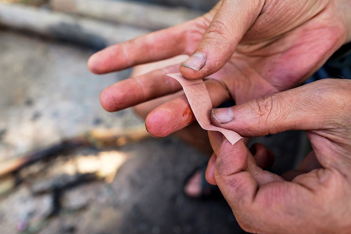 How to care for wounds in the outdoors for basic mishaps