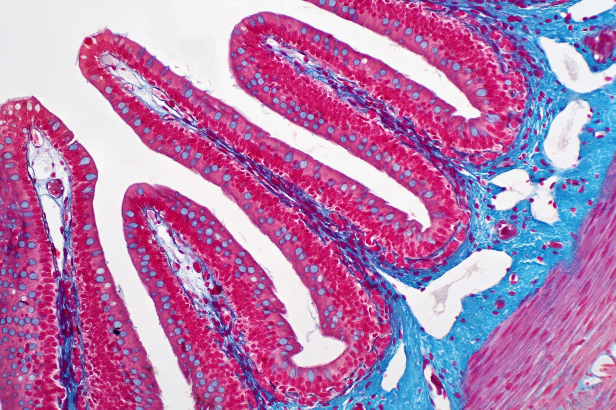 Here’s How I Knew I Had Colon Cancer