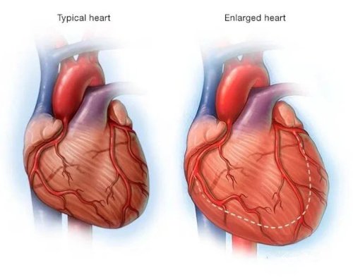 Think You're Heart-Healthy? Try This 60-Second Test that Reveals All!