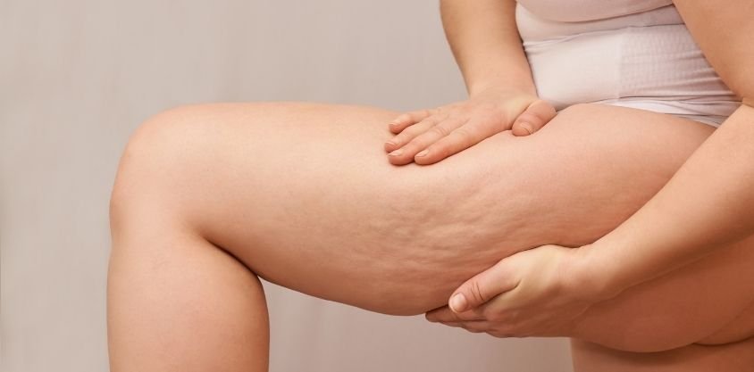 These Best Leg Exercises for Women Will Blast Fat and Transform Your Legs