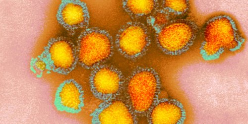 Auf Menschen übertragbar: Schwerste Vogelgrippe-Epidemie aller Zeiten - was Sie wissen müssen