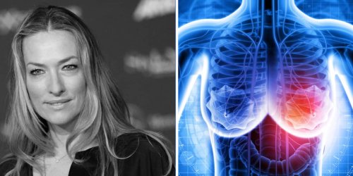Supermodel Tatjana Patitz daran gestorben: 7 Warnsignale bei Brustkebs sollte jede Frau ernst nehmen