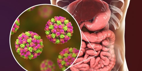 Löst Brechdurchfall aus: Doppelt so viele Norovirus-Fälle wie im Vorjahr – so schützen Sie sich