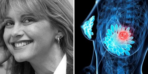 Jede 8. Frau erkrankt: Olivia Newton-John an Brustkrebs verstorben: Wie Sie Ihr Risiko reduzieren