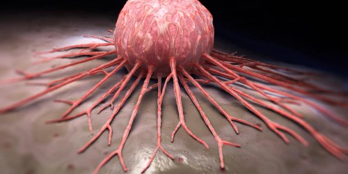 Forscher sind begeistert: Diese Therapie lässt Krebszellen verschwinden - Video
