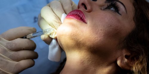 Gesellschaft: Schulbehörde warnt auf Instagram vor Hyaluron-Spritzen